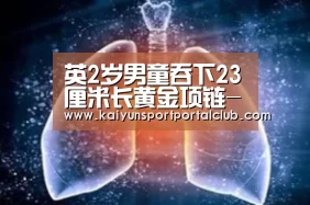 英2岁男童吞下23厘米长黄金项链-开云体育官网(图1) 开云体育官网